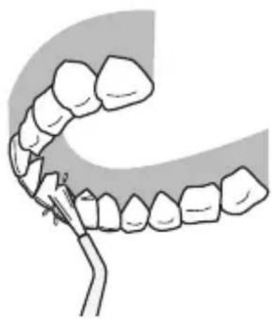 PANASONIC EWDJ10 - Back side of the teeth... - 1