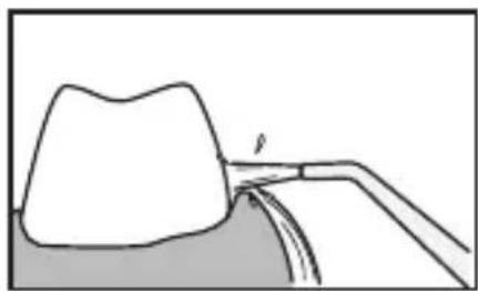 PANASONIC EWDJ10 - For the lower teeth - 1