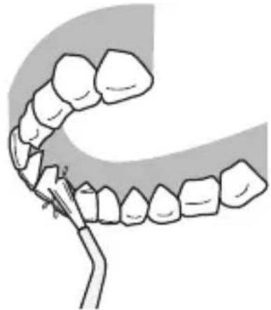 PANASONIC EWDJ10 - Tylna strona zębów... - 1