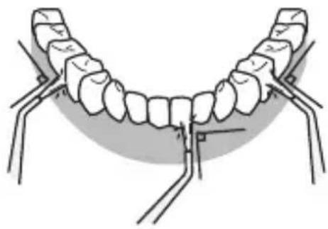 PANASONIC EWDJ10 - Tændernes forbide... - 1