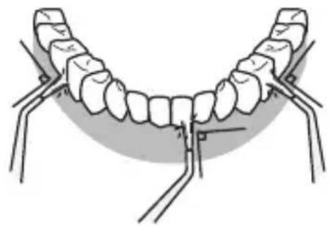 PANASONIC EWDJ10 - Front side of the teeth... - 1