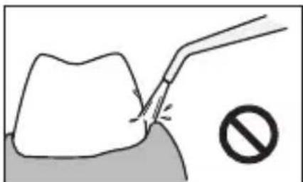 PANASONIC EWDJ10 - Per i denti inferiori - 2