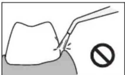 PANASONIC EWDJ10 - Pour les dents du bas - 2