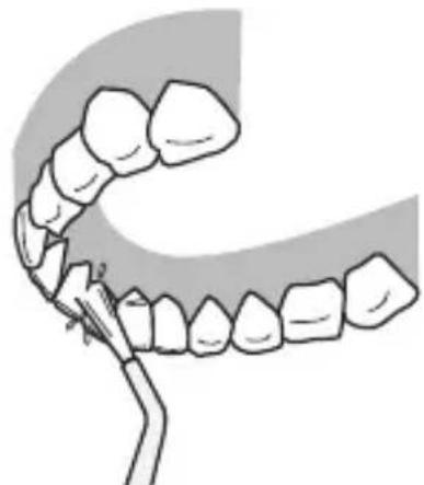 PANASONIC EWDJ10 - Face postérieure des dents... - 1