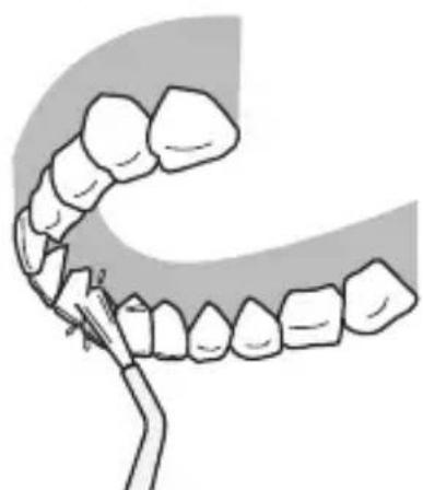PANASONIC EWDJ10 - Parte posterior de los dientes... - 1