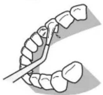 PANASONIC EWDJ10 - For the upper teeth - 1