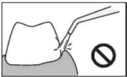 PANASONIC EWDJ10 - Bei den unteren Zähen - 2