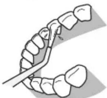 PANASONIC EWDJ10 - Per i denti superiori - 1