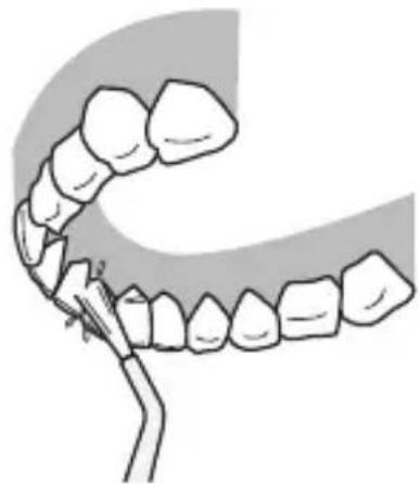 PANASONIC EWDJ10 - Rückseite der Zähne... - 1