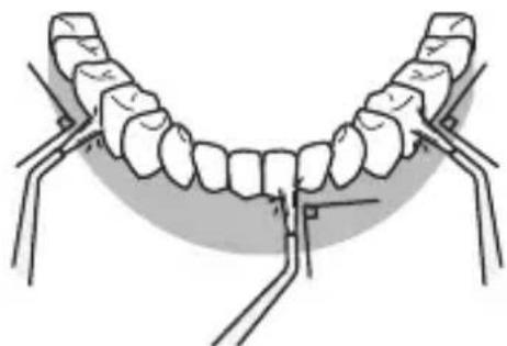 PANASONIC EWDJ10 - Předné strana zubů... - 1