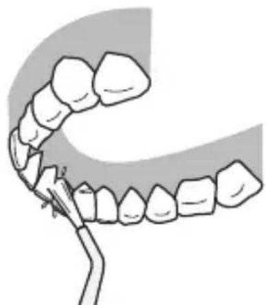 PANASONIC EWDJ10 - Tændernes bagside... - 1