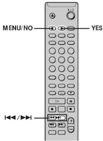 SONY MDSPC2 - Undoing the Last Edit - 1