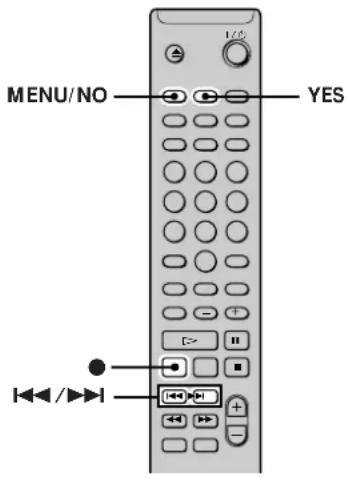 SONY MDSPC2 - Marking Track Numbers While Recording (Track Marking) - 1