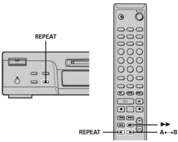 SONY MDSM100 - Reproduccion repetida de canciones - 1