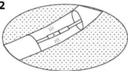 EXIT Elegant Premium - Elegant Deluxe Safetynet - 4