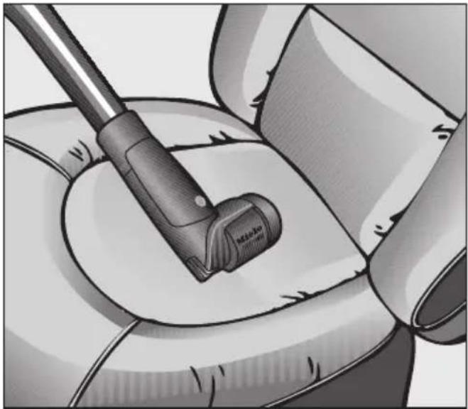 MIELE STB 20 - Insertion de la mini-turbobrosse - 1