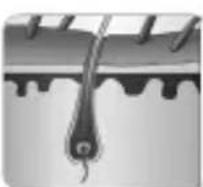 SANITAS IPL 80 - IPL technology – how it works - 1