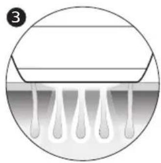 PHILIPS BG9040 - Principe de fonctionnement de la lumière pulsée intense - 3