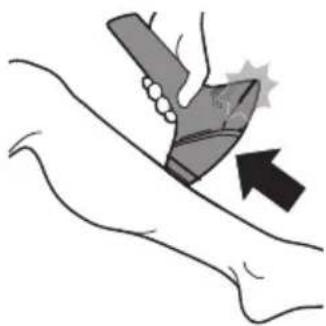 PHILIPS BG9040 - Deux modes de traitement : Tamponner-flasher et glisser-flasher - 2