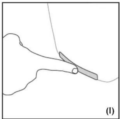 Maybaum Caldero TO 550 - PFLEGE DES TOASTERS UND REINIGUNG - 1