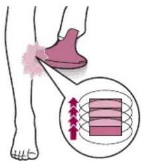 PHILIPS Lumea Advanced BRI922 - C Behandeling - 5
