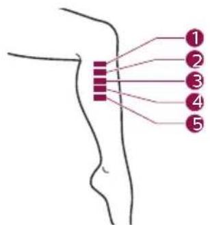 PHILIPS Lumea Advanced BRI922 - B Test skin 24 hrs before treatment - 9