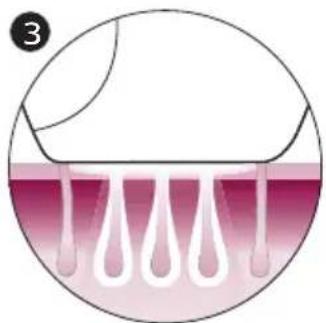 PHILIPS Lumea Advanced BRI922 - How IPL works - 3