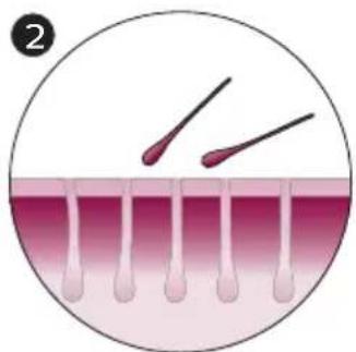 PHILIPS Lumea Advanced BRI922 - How IPL works - 2
