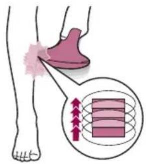PHILIPS Lumea Advanced BRI922 - Deux modes de traitement : Positionner-flasher et glisser-flasher - 2