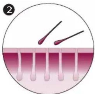 PHILIPS Lumea Advanced SC1994 - How IPL works - 2