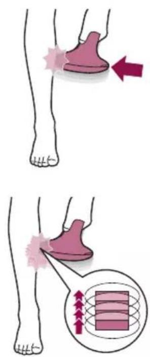 PHILIPS Lumea Advanced SC1994 - Deux modes de traitement : Positionner-flasher et glisser-flasher - 1