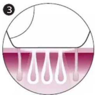 PHILIPS Lumea Advanced SC1994 - How IPL works - 3