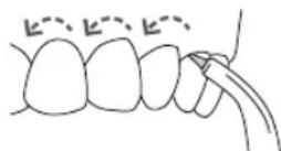 Waterpik WF02E1011 - UTILISATION DE L'embout Embout Pik Pocket - 2