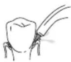 Waterpik WF02E1011 - Toothbrush Tip - 1