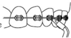 Waterpik WF02E1011 - Embout Brosse à dents - 2