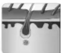 BEURER PureSkinPro - How does the light remove the hair? - 2