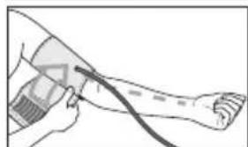 BEURER BM 47 - Colocacion del brazalete - 2