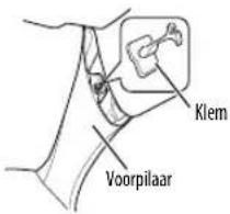 KENWOOD KMMBT504DAB - ▲ Voorzorgen Indien de antennekabel in de voorpilaar wordt geplaatst en een airbag is gemonteerd - 1