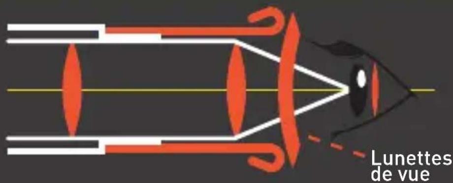 Bynolyt Sparrow WPR 10x32 - FOCALISATION - 1