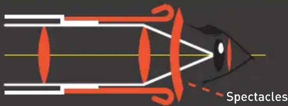 Bynolyt Sparrow WPR 10x32 - PUPIL DISTANCE - 1
