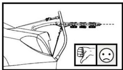 Yakima HalfBack 2 - Relever les bras. - 4
