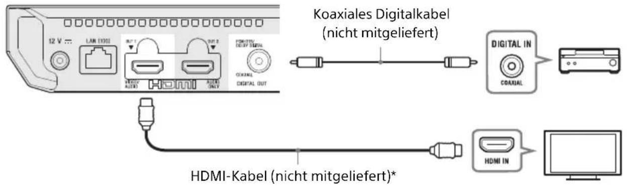 SONY UBPX500B - Anschließen an Ihr Fernsehgerät per Soundbar/AV-Verstärker (Receiver) - 3