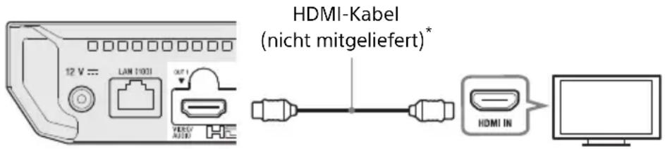 SONY UBPX500B - Anschließen an Ihr Fernsehgerät - 1