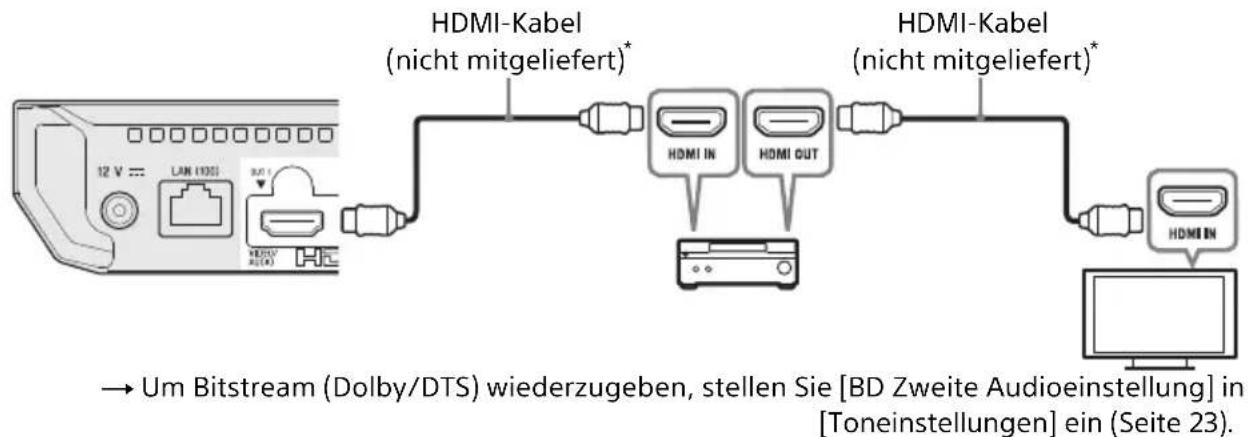 SONY UBPX500B - Anschließen an Ihr Fernsehgerät per Soundbar/AV-Verstärker (Receiver) - 1