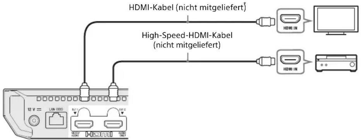 SONY UBPX500B - Anschließen an Ihr Fernsehgerät per Soundbar/AV-Verstärker (Receiver) - 2