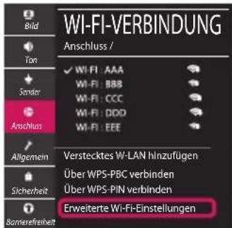 LG 43UM7400PLB - Netzwerkeinstellungen - 5