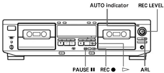 SONY TCWE425 - Adjusting the Recording Level Automatically (Auto Rec Level) - 1