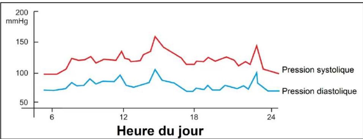 Orbegozo TES 4650 - Santé et pression sanguine - 1