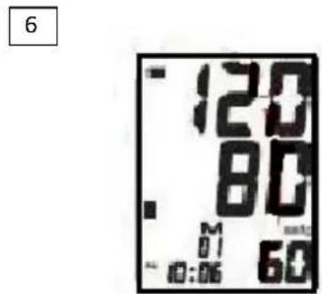 6 120 80 M 01 10:05 60