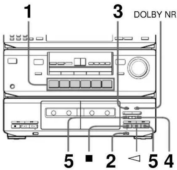 SONY HST471 - Enregistrement sur une cassette - 1